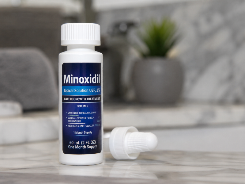 Telogen Effluvium e Minoxidil