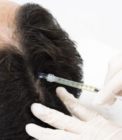 Mesoterapia