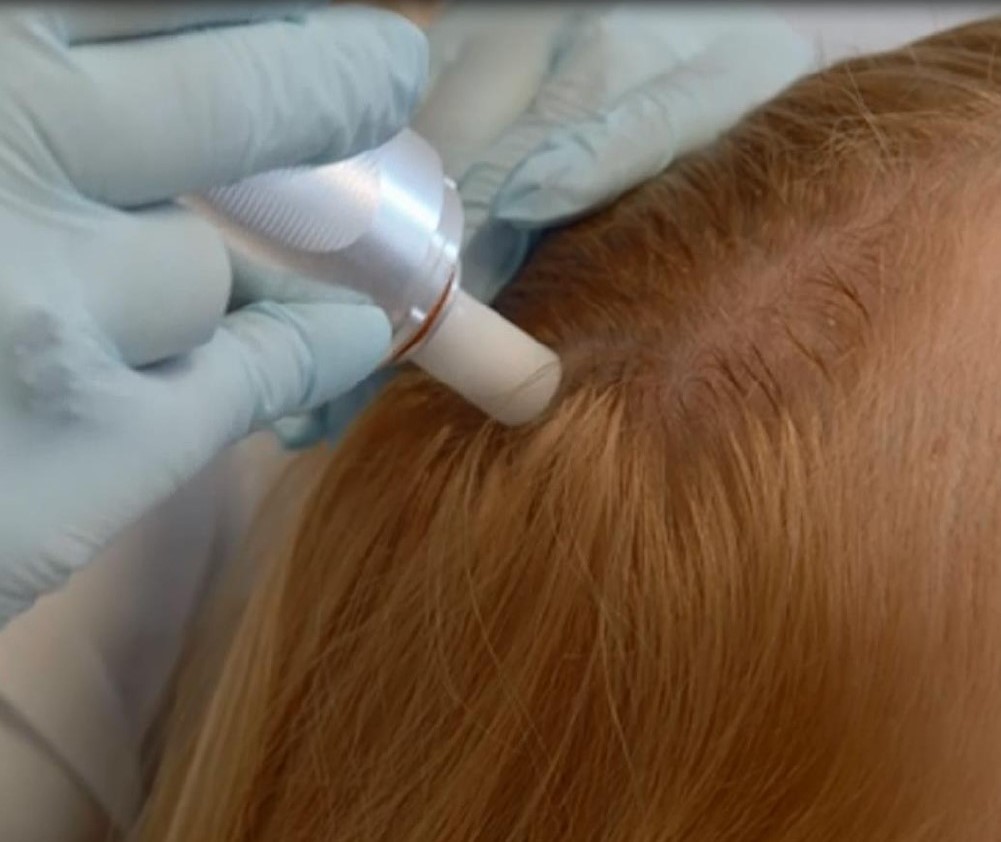 Tricologia medica a Milano Centro