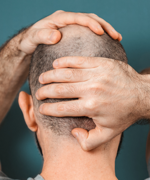 Trapianto di capelli a Milano Centro
